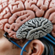 The first human brain implant